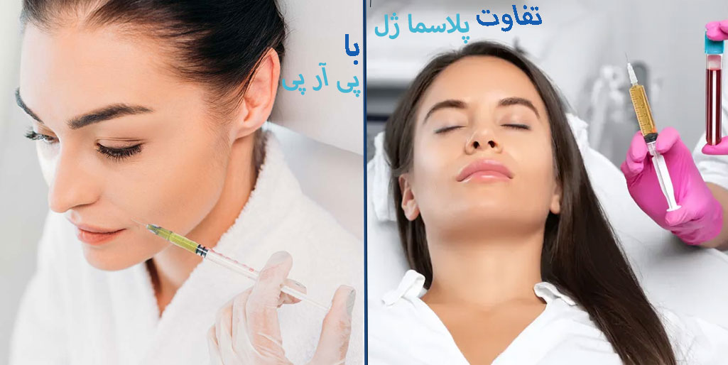تفاوت پلاسما ژل و پی آر پی